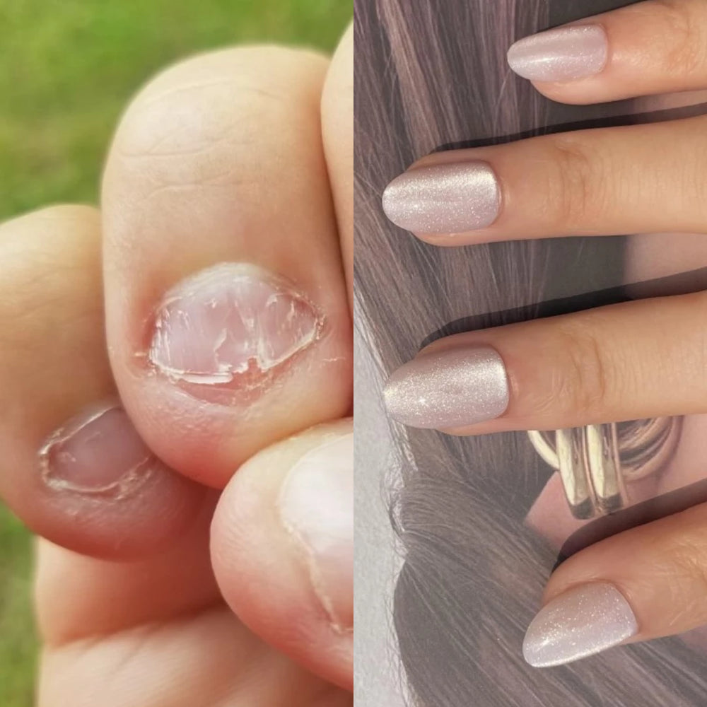 ONGLES RONGÉS